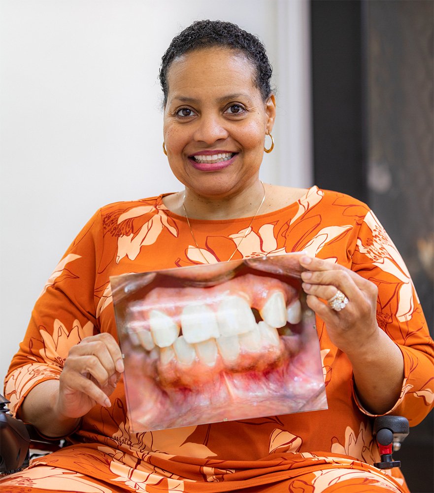 Happy patient holding a "before" image of her smile