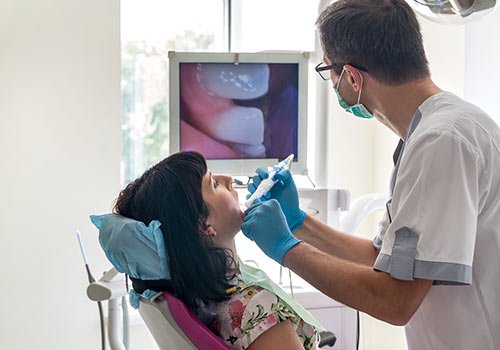 Intraoral Camera Scanner